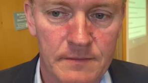 Longford #LE24: Senator Miche&aacute;l Carrigy reacts at FG top poll in the three Longford MDs