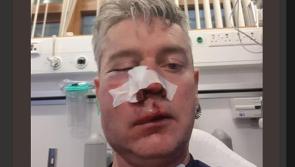 Lifetime ban for spectator and three players banned for 40 years following vicious assault on soccer referee