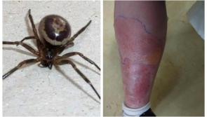Deadly false widow spider can produce 1,000 babies a year