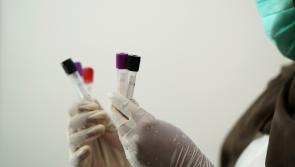 Doctor expresses concern over lack of HPV screening after man with 'genital warts' dies