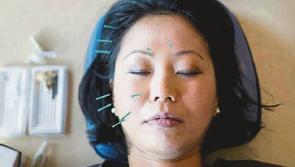 OTHER SIDE OF THE COIN: Treating headaches with acupuncture