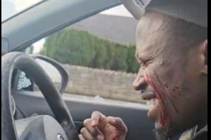 ‘The day the world went dark’: Dancer who performed in Longford left blind after man smashed car window