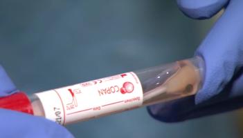 Families of health workers who died of Covid-19 can now apply for €100k payment