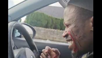 &lsquo;The day the world went dark&rsquo;: Dancer who performed in Longford left blind after man smashed car window