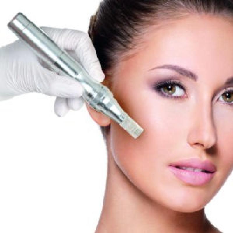 Microneedling 