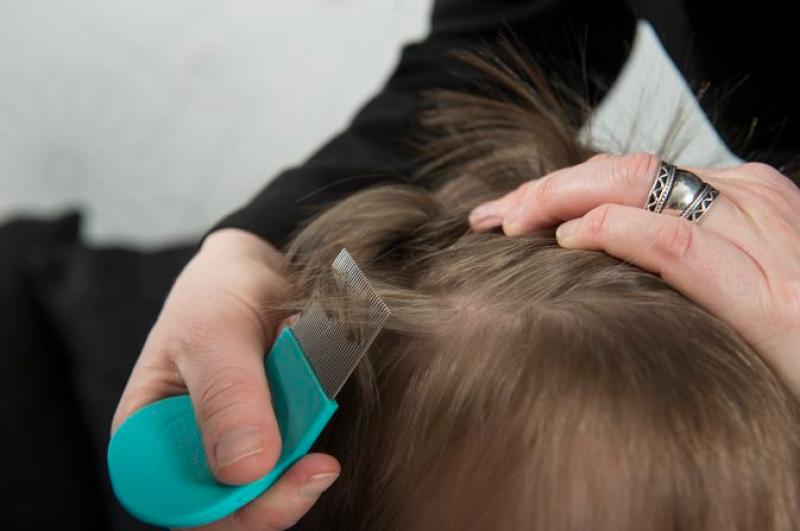 Back to School – Pharmacists’ advice on treating Head Lice 