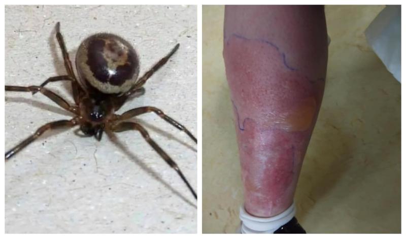 Deadly false widow spider can produce 1,000 babies a year