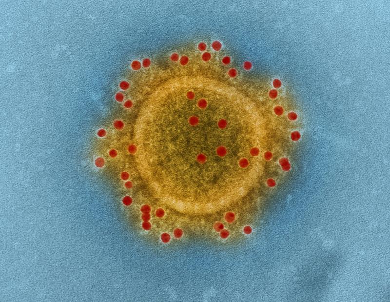Warning that common health condition worsened by Covid-19