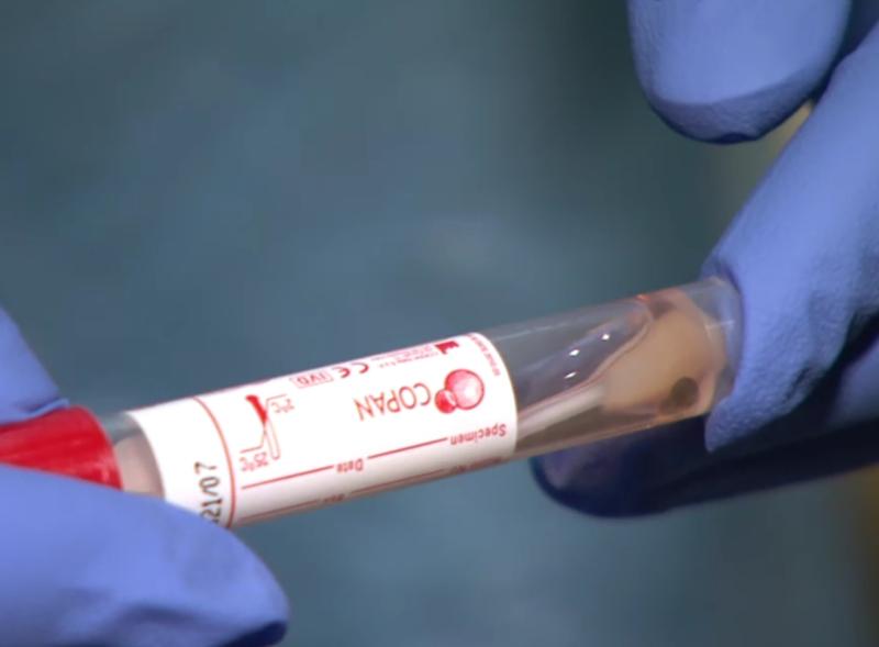 REVEALED: How long are you immune if you've had Covid-19?