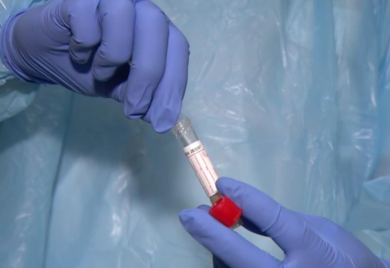 coronavirus covid-19