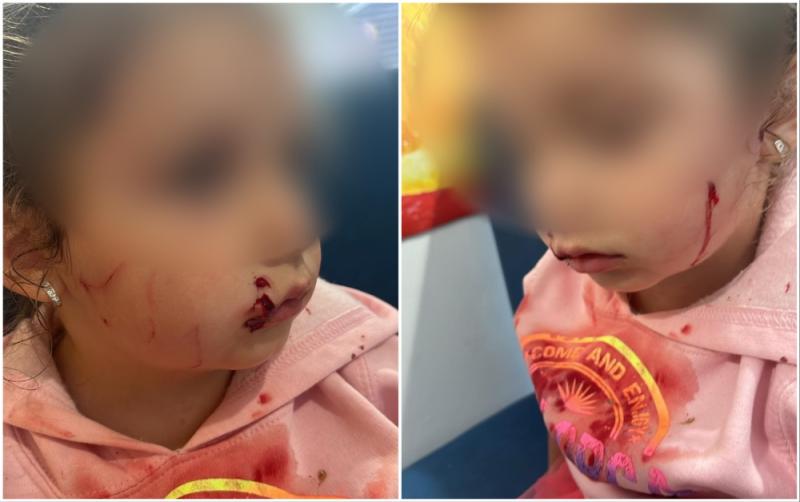 'We're in shock' - Horror cat attack in Ballymahon leaves 3 year-old Longford girl scarred