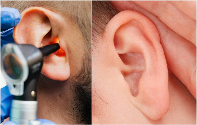 EXPLAINER: Old wives' tale 'cure' for blocked ear actually true as HSE issue advice