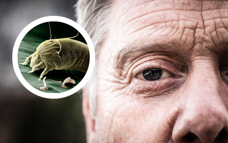 'I can't take any more' - Warning over tiny insects that live on your face