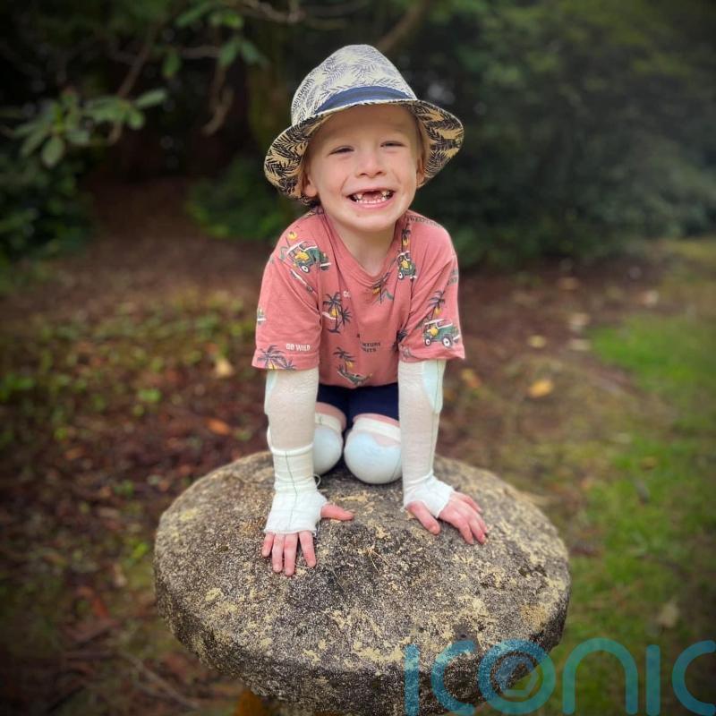 Book about ‘warrior’ four-year-old helps classmates understand skin condition